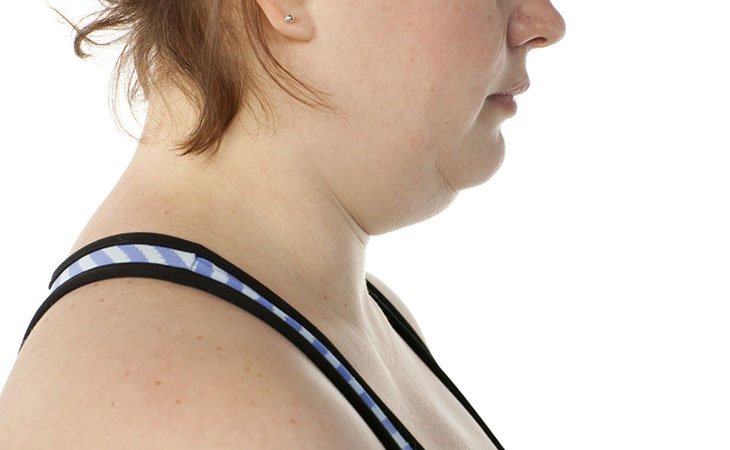 How To Lose Neck Fat – The Best Ways In 2022!