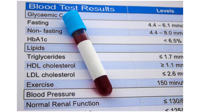 What Did Your Cholesterol Levels Mean?
