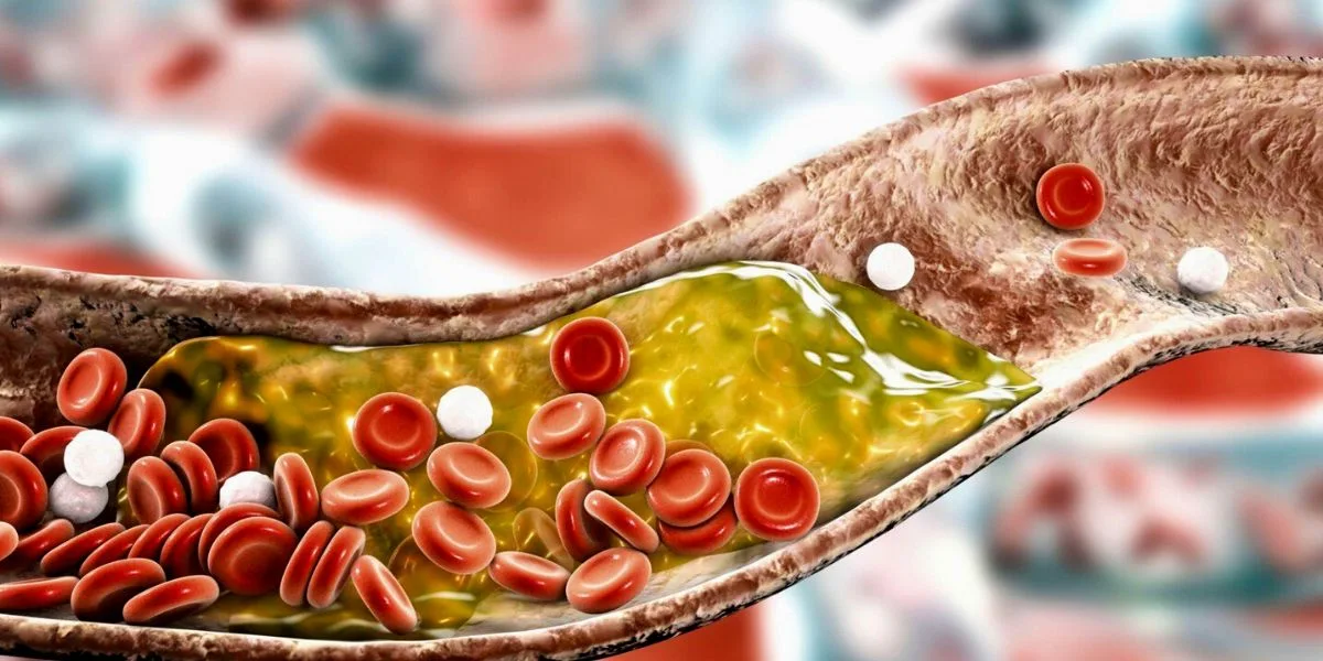 Is High Cholesterol Genetic - Here's The Truth!
