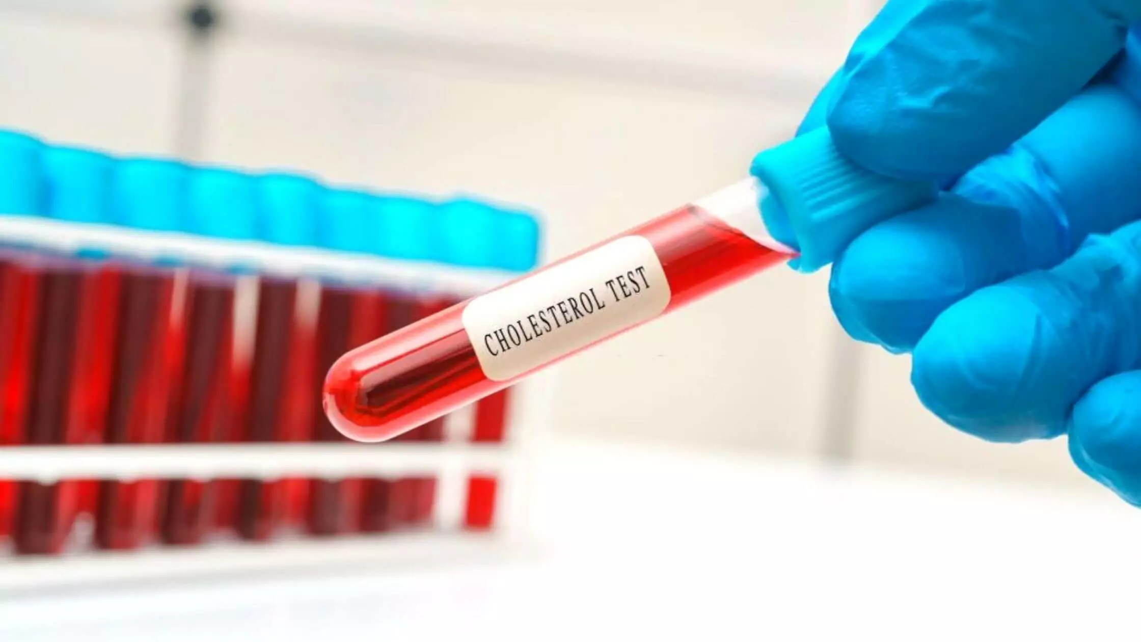 What Should I Avoid Before A Cholesterol Test
