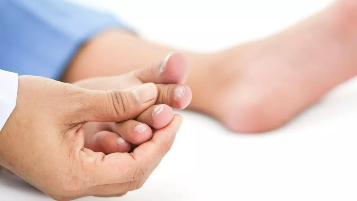 Can High Cholesterol Affect The Feet Symptoms And Treatments