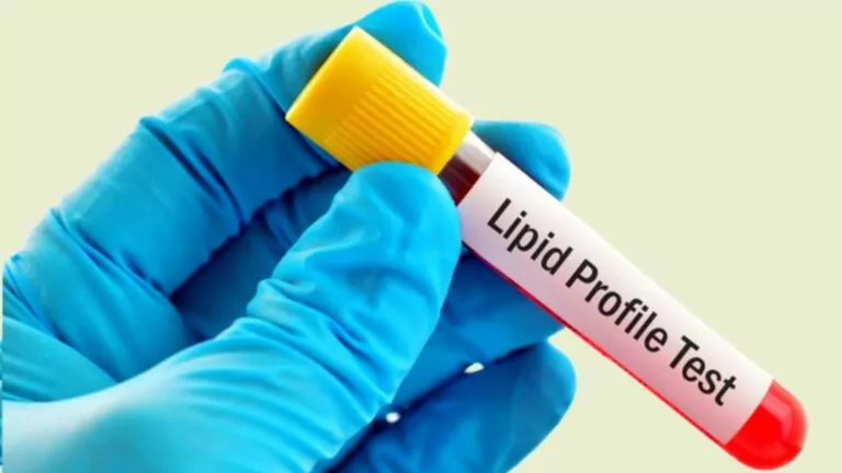 Lipid Panel Test – Everything You Need To Know!