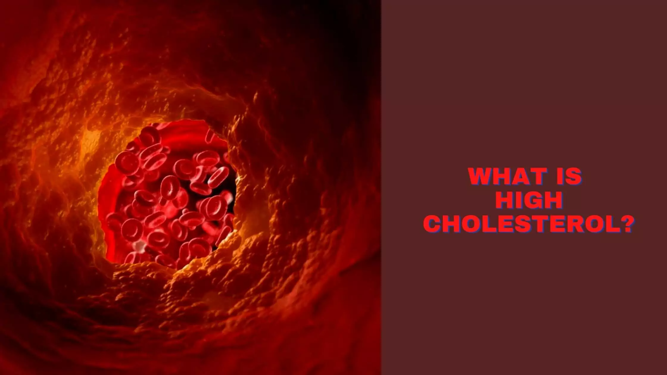 All About High Cholesterol
